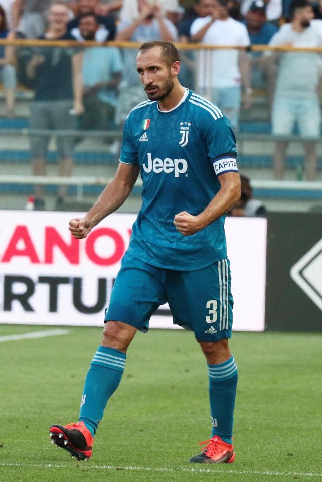 雷迪克：很少有球队没可被对手利用的弱点，但我们反复被针对